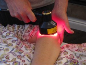 Laser treatment for arthritis.